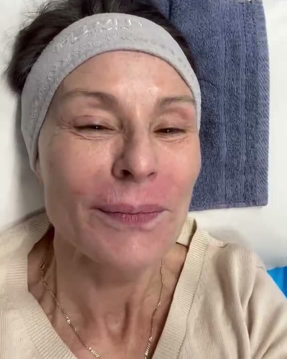 Mesoterapia facial para mejorar la calidad de la piel, Clínica Pujol y Plaza, Chamberí, Madrid